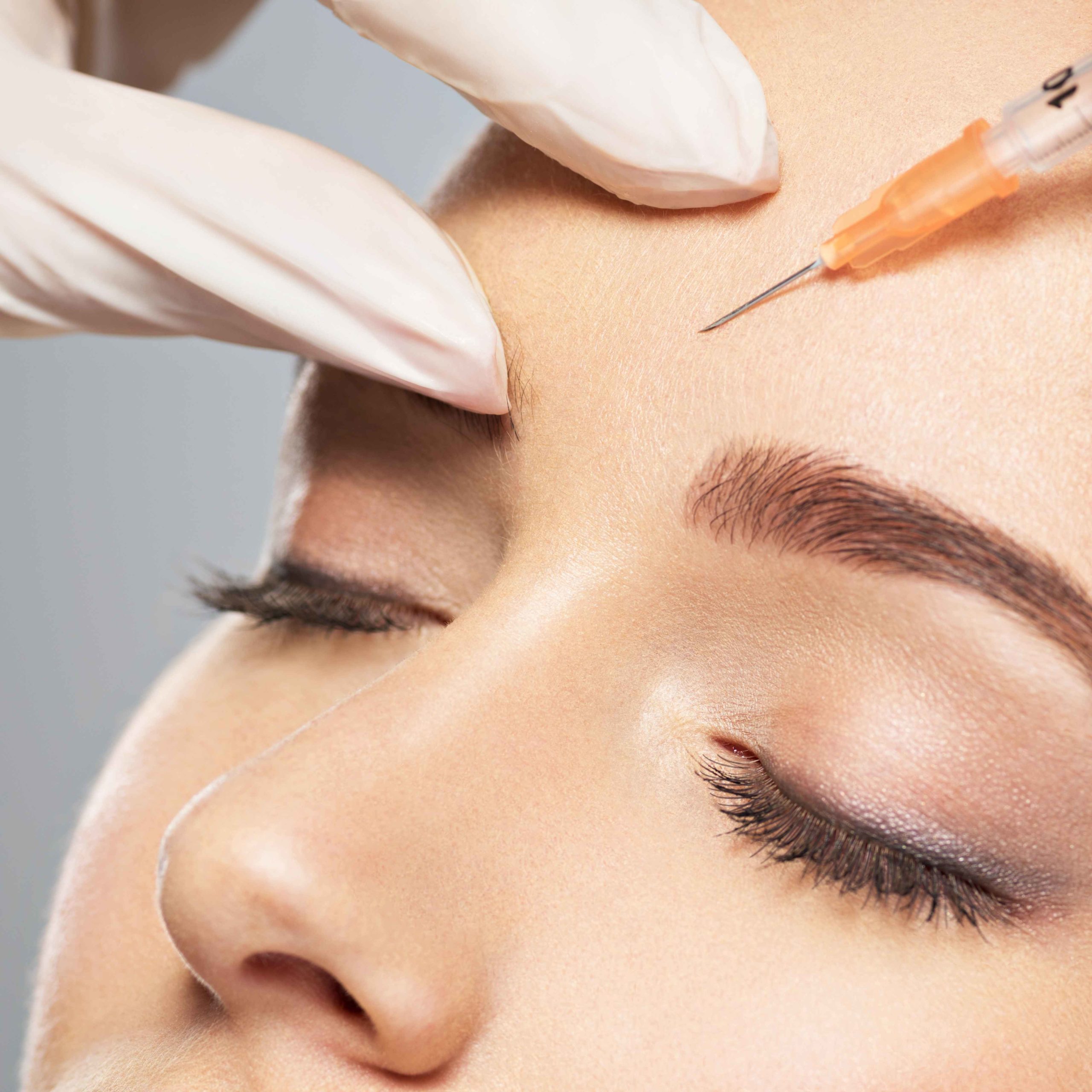 Wrinkle Relaxers | Onyx Medical Aesthetics | Homann Dr. S.E. suite B Lacey, WA