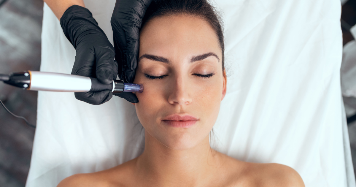 Woman receiving Microneedling facial treatment in Lacey, WA