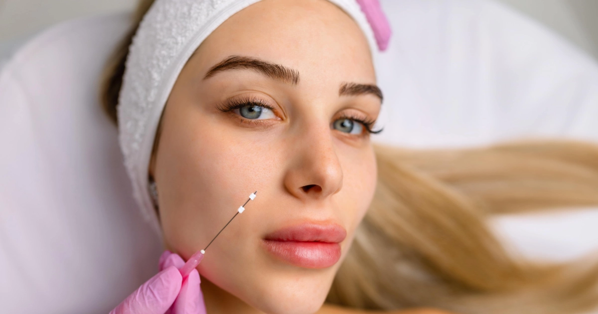 Woman receives a facial PDO Thread Treatment in Lacey, WA, with a practitioner holding a needle near her cheek.